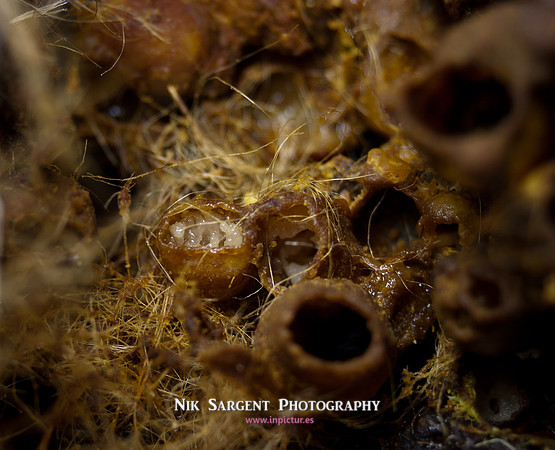 beepol autopsy-3790